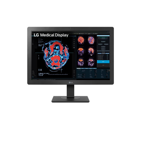 LG 24" (16:10) 2MP CLINICAL REVIEW MONITOR WITH CALIBRATION SENSOR & LCS CALIBRATION, 5YR